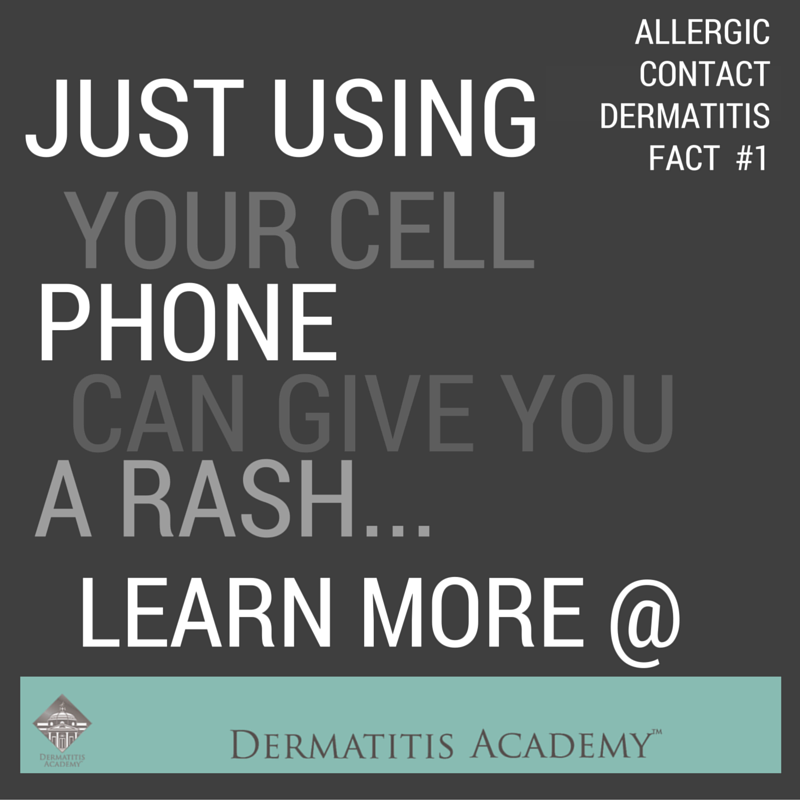 What you need to know about allergic contact dermatitis, especially to nickel.