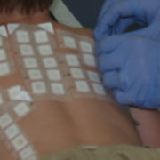 pediatric patch test