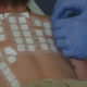 pediatric patch test