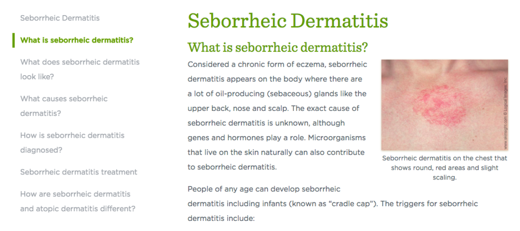 Seborrheic Dermatitis Main Page Dermatitis Academy